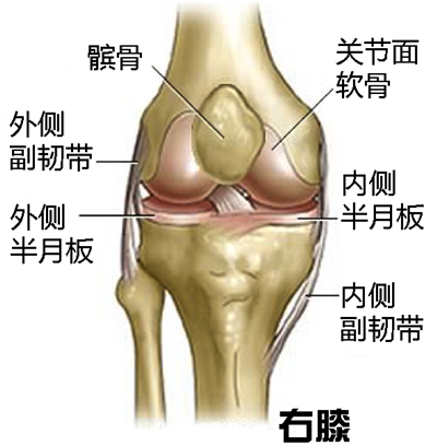 长期跑步给膝关节带来的反复冲击(髌骨与股骨反复碰撞)导致膝关节劳损